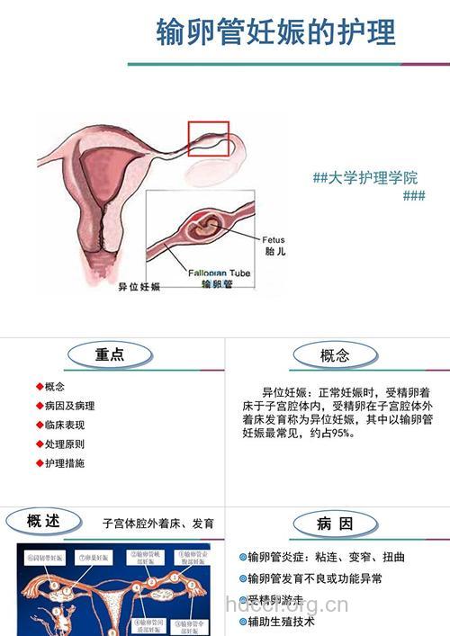 输卵管妊娠的鉴别方法