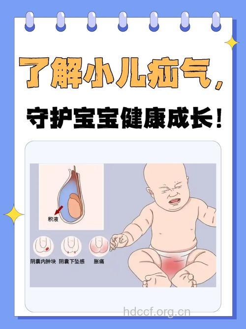 婴儿疝气