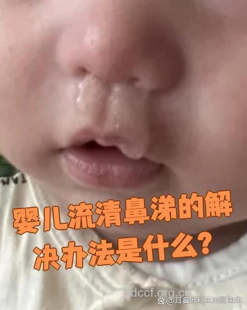 婴儿过敏性鼻炎