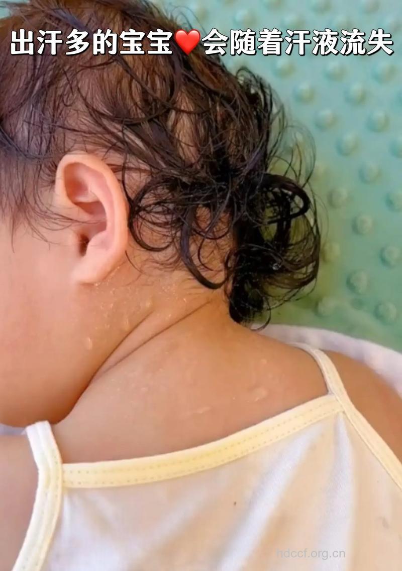 宝宝汗多