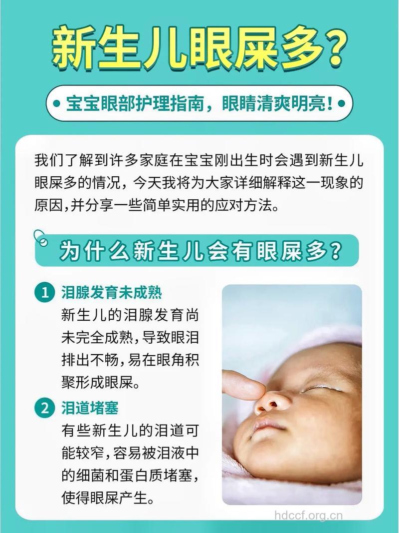 宝宝眼屎多怎么办