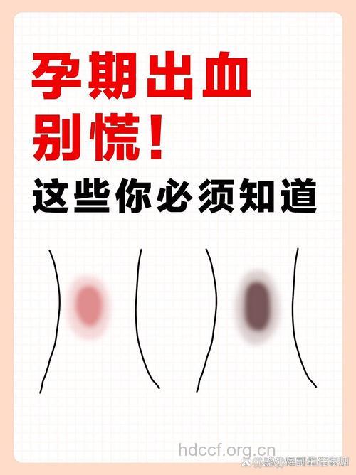 怀孕后来月经？孕期见红6原因