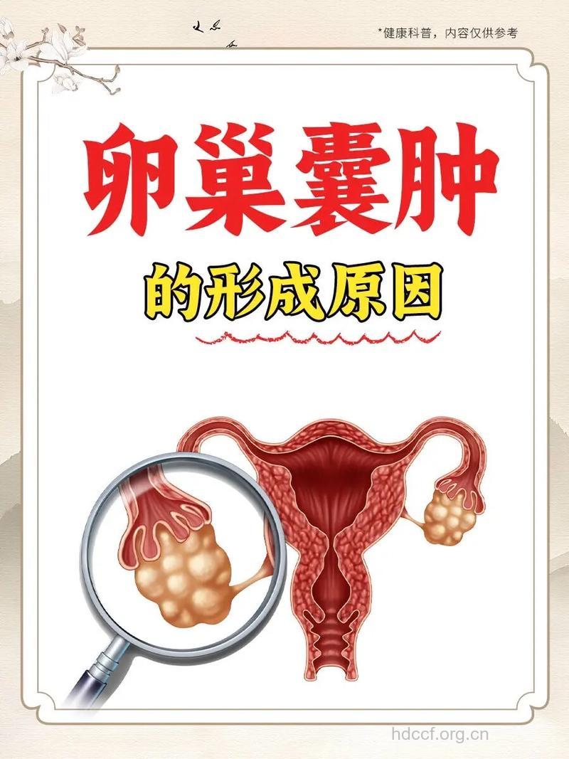 卵巢囊肿为什么会诱发女性不孕