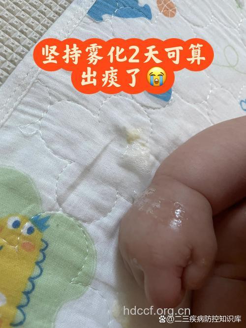 宝宝咳嗽有痰