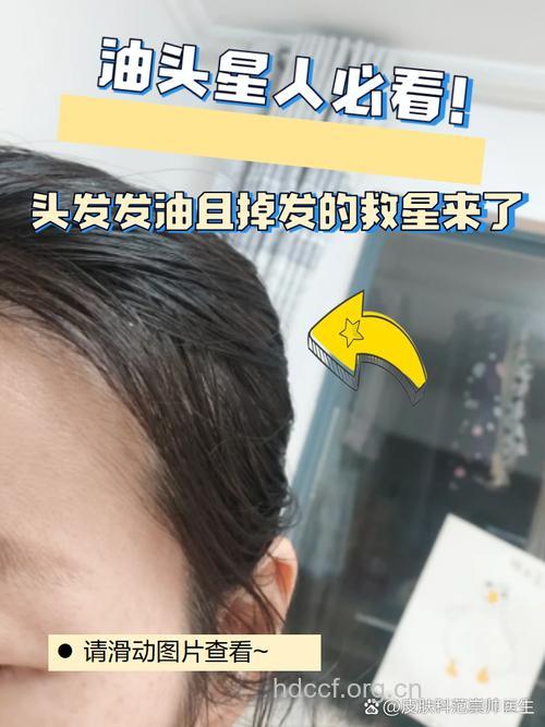 4种原因导致女人发质越来越差 想拥有秀发要认真护发