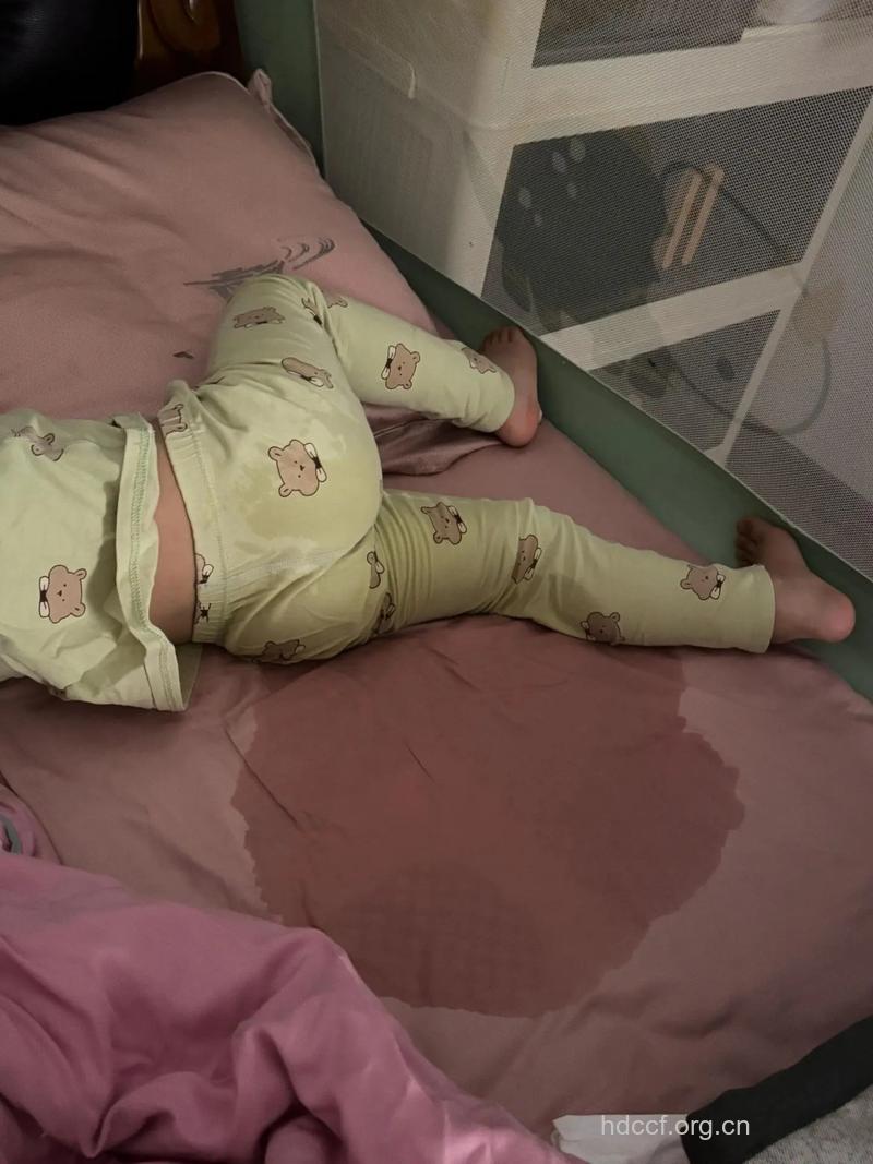 小孩尿床