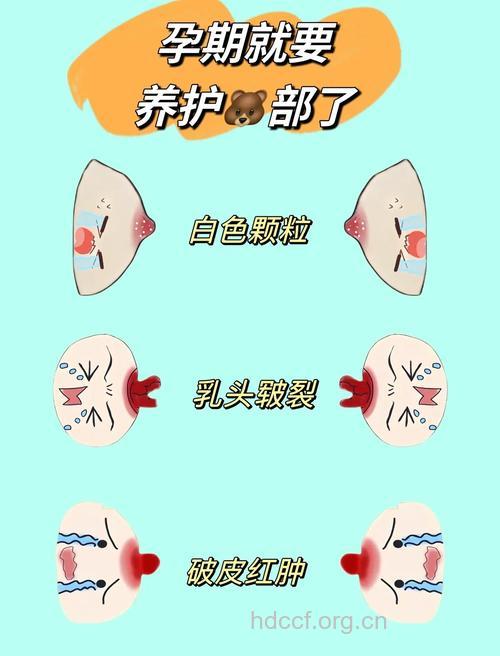 生完孩子后乳晕会变小吗 如何护理乳晕