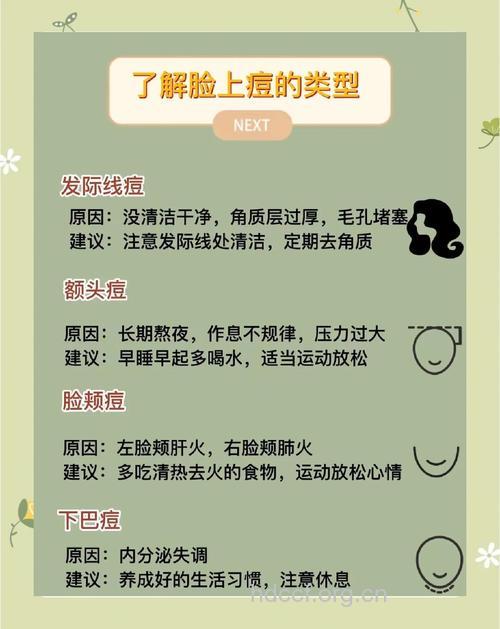 产后长痘怎么办 去痘的小窍门