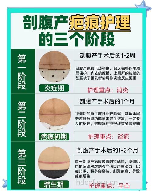 剖腹产疤痕如何淡化 这些方法要知道