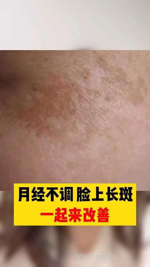 从女性脸色来查看月经不调