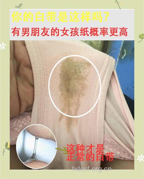 女性4种“问题”内裤 再心疼也要果断抛弃