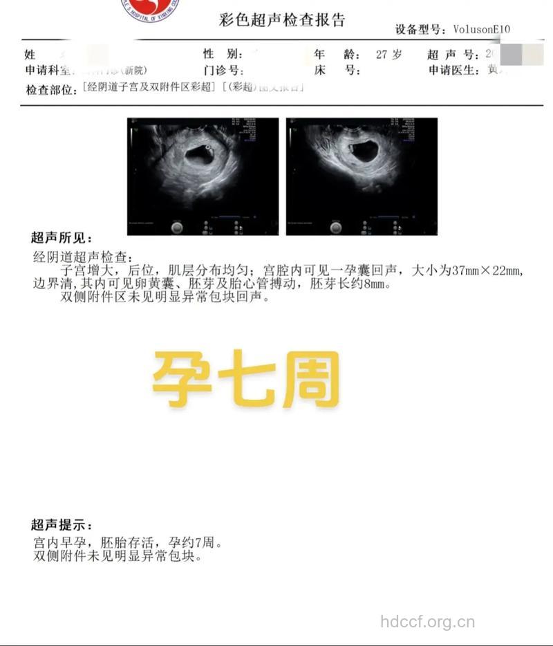 月经推迟5天要做怀孕检查