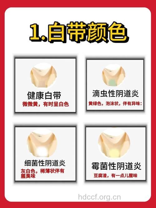 不同颜色白带可辨别阴道炎