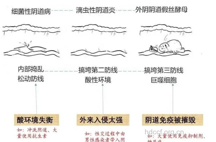 你了解阴道炎的蛛丝马迹了吗