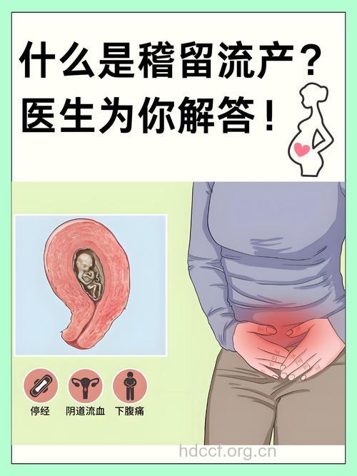 稽留流产的原因和症状有哪些