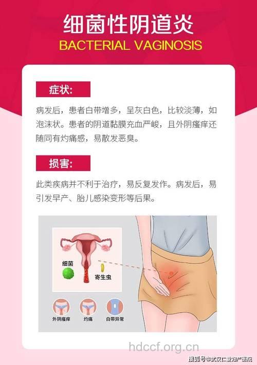 不同的阴道炎痛痒感相同吗？