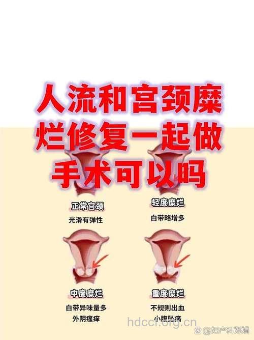 有妇科炎症能进行人流手术吗