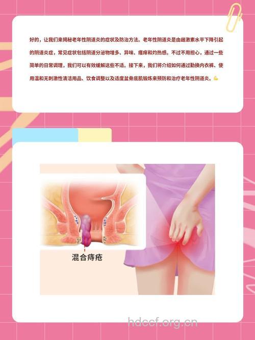 老年性阴道炎的几点注意
