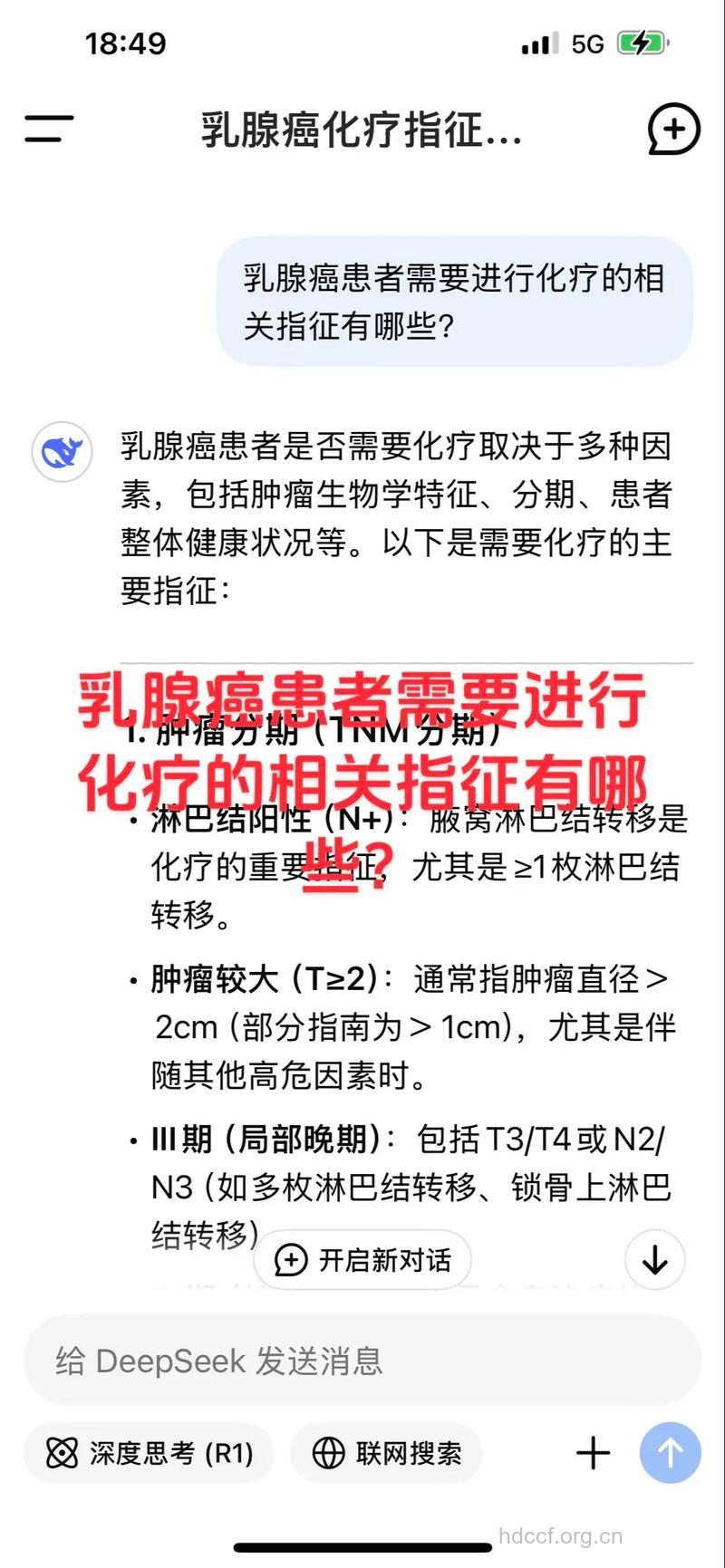 乳腺癌治疗 “零期癌”患者无需化疗