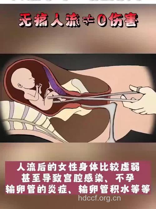 14周做人流的过程