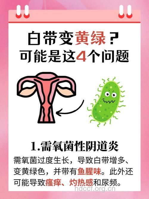白带异常黄绿色有异味怎么办 尽早就医诊断是关键