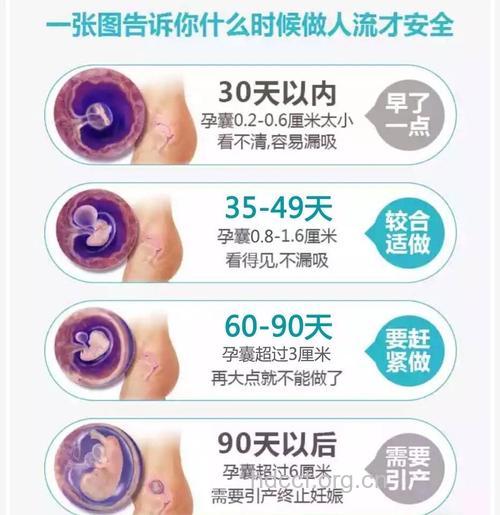 人流在什么时间做最佳