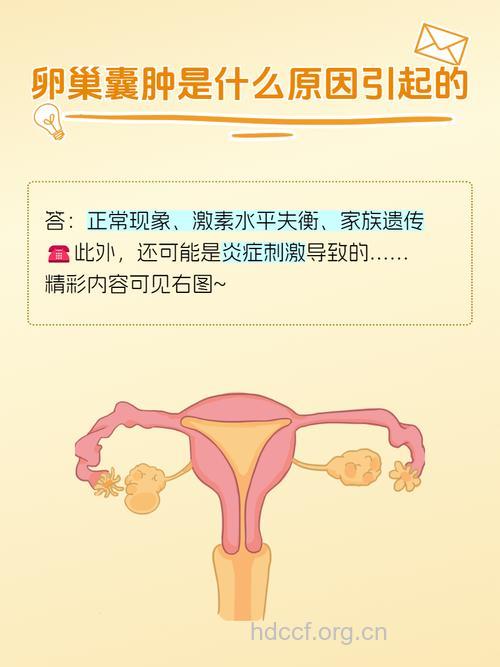 为什么会患上卵巢囊肿