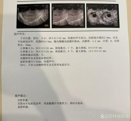 无痛人流后35天没来月经正常吗