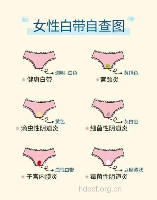 白带异常警惕妇科病 女人4种体质私处白带多