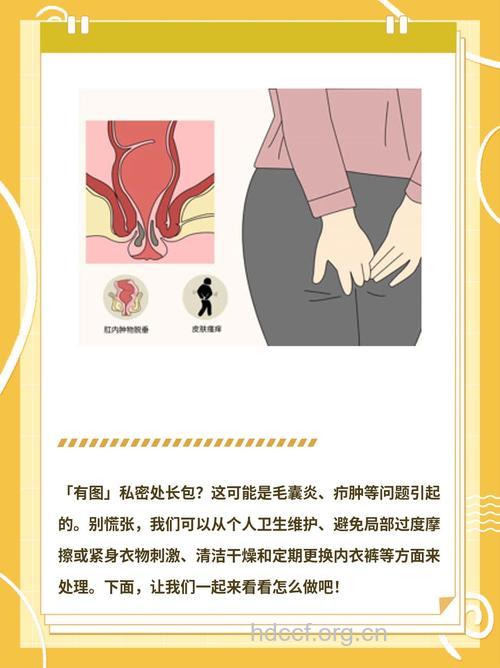 女性外阴长了个包是怎么回事 元凶是它