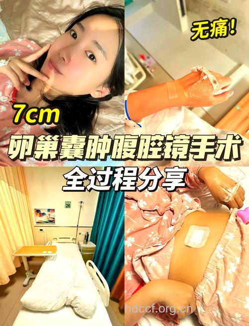 卵巢囊肿手术要怎么进行