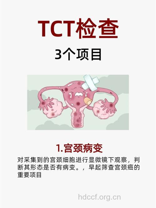 有性生活的女性每年都要做TCT检查