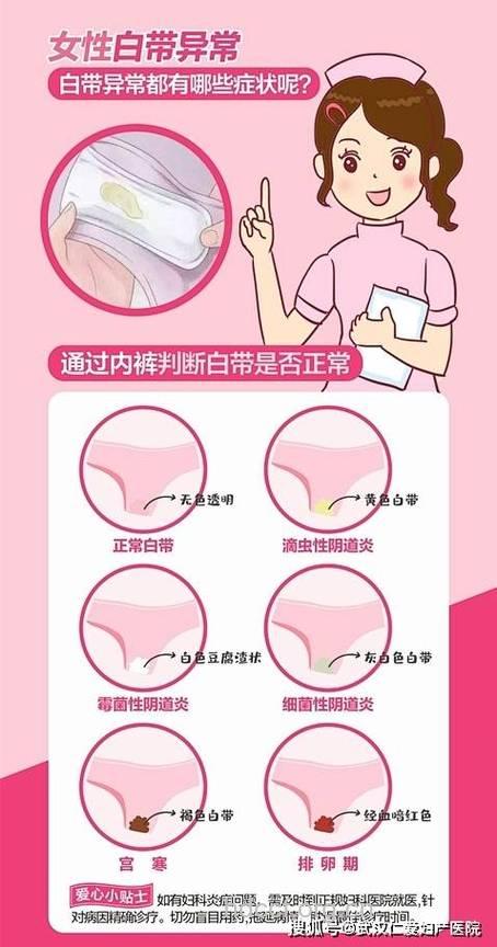 褐色豆腐渣分泌物是怎么回事