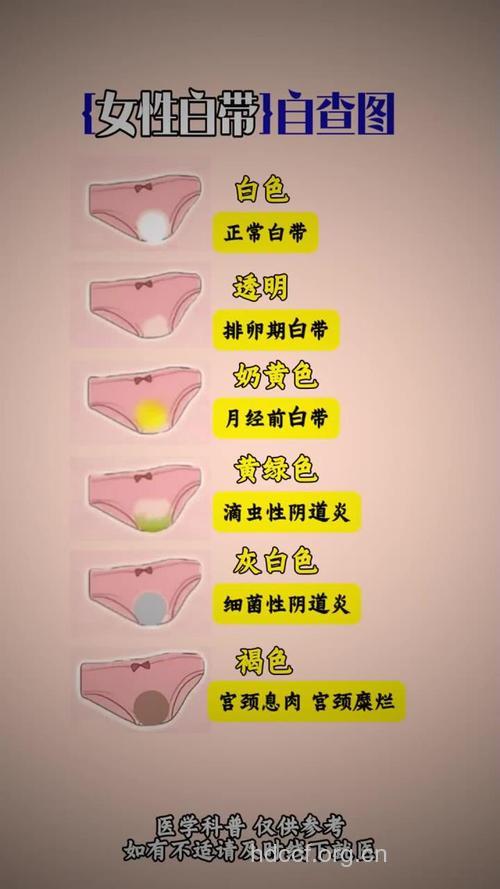 白带多少 看穿女性私处健康