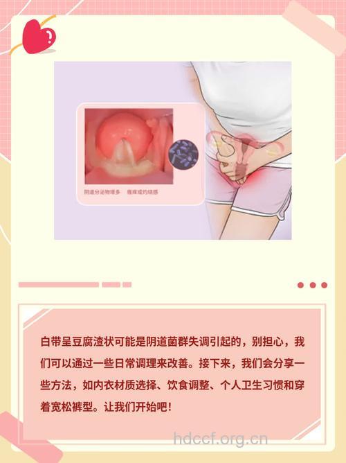 处女白带豆腐渣状分泌物怎么回事