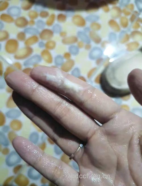 白带豆腐渣状图片 中药治疗白带异常