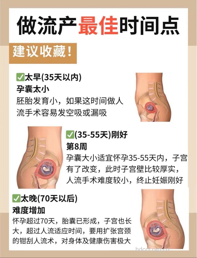 怀孕30天能做人流吗