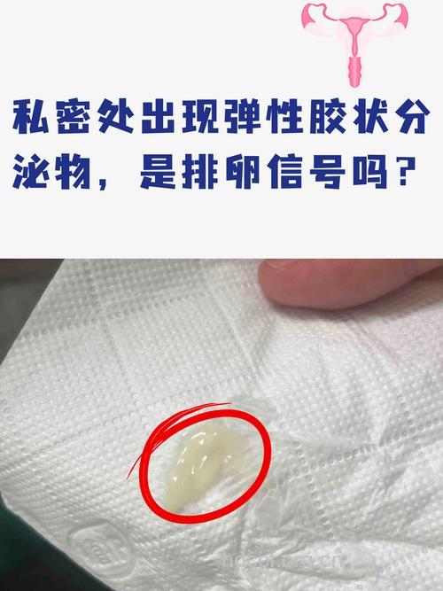 白带粘稠像胶水怎么回事