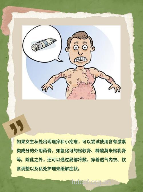 女人夏季私处瘙痒怎么办 试试这么缓解