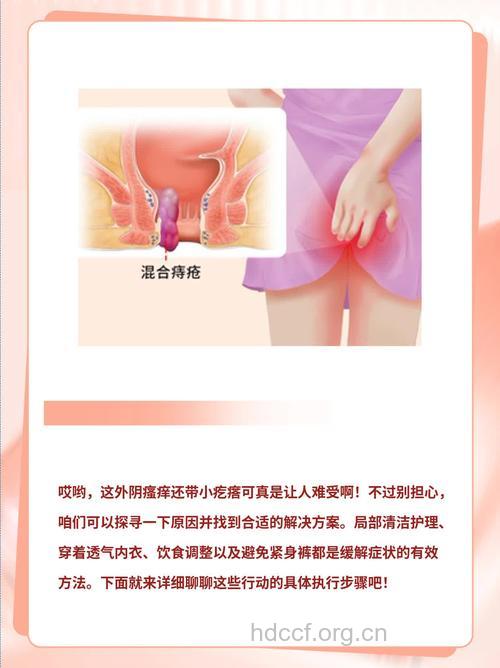 外阴瘙痒有小疙瘩 4招帮你赶走瘙痒症