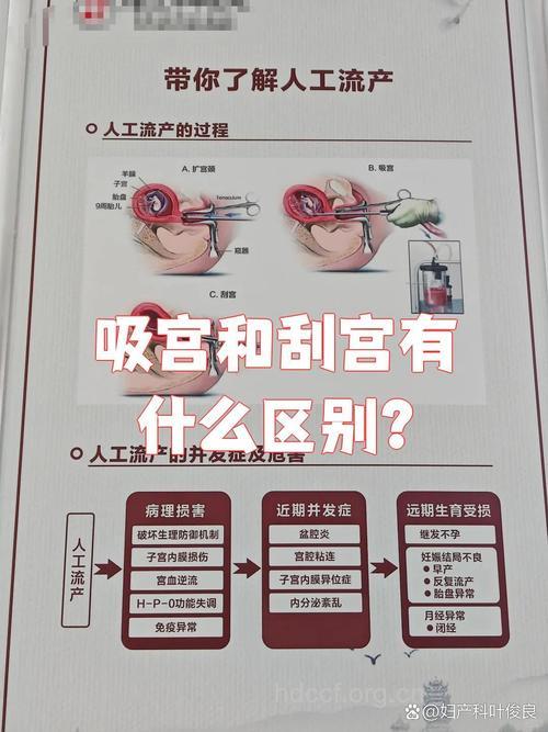 怎么样区别清宫和刮宫？
