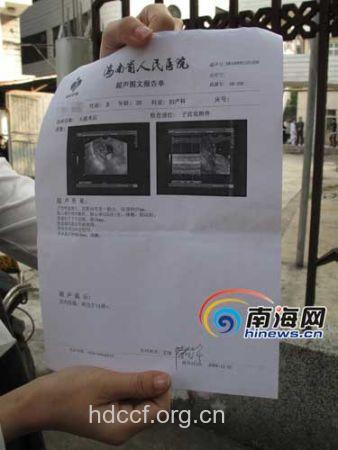人流后B超能检查出做过人流吗？
