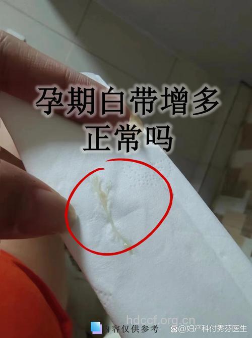 怀孕白带是什么样的