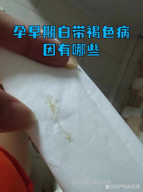 怀孕初期白带褐色正常吗