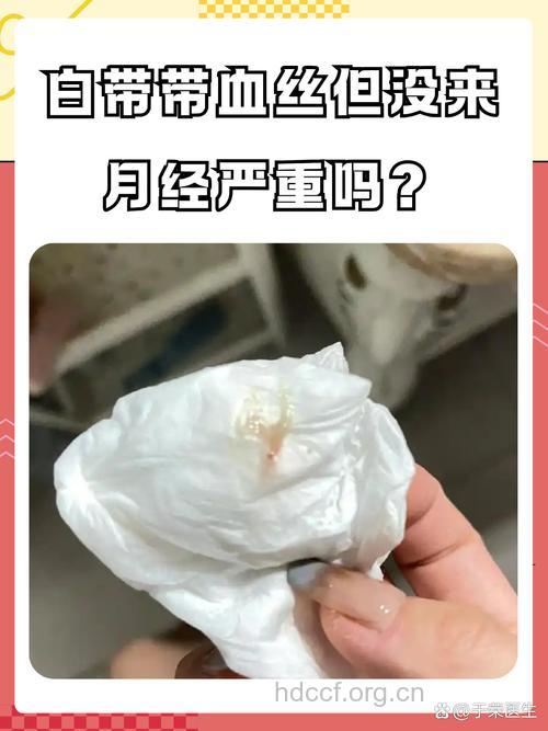 白带有血丝是妇科癌症前兆吗
