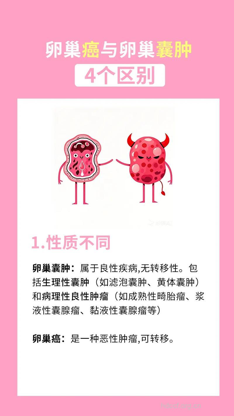 卵巢囊肿和卵巢肿瘤的区别 具体是什么