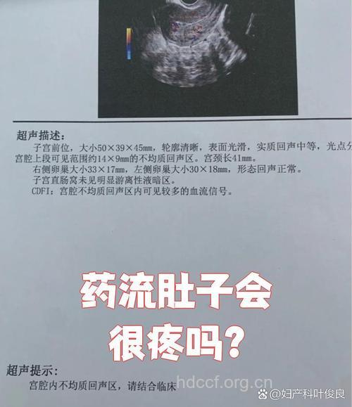 药物流产会很疼吗？
