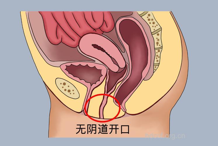 石女有哪些身体特征 没有月经是最大特征