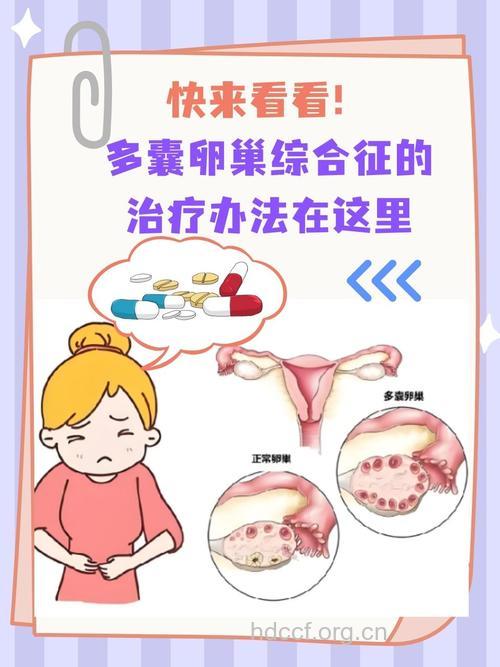 多囊卵巢综合征怎么治疗 4种方式可选择