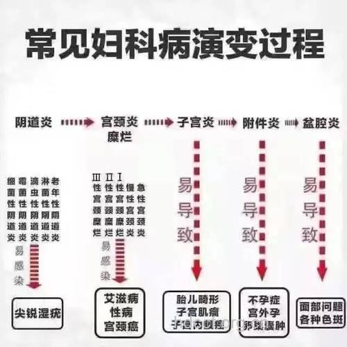得了阴道炎 注意3大误区5大症状